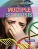 Multiple_Sclerosis