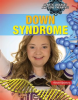 Down_Syndrome